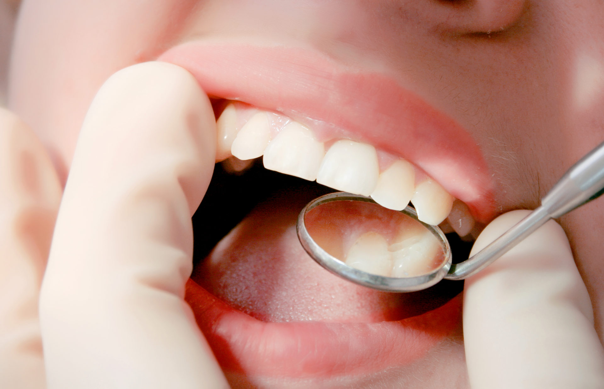 一般歯科診療